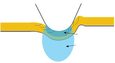 5-Tensile-and-compressive-stresses tensile and compressive stresses